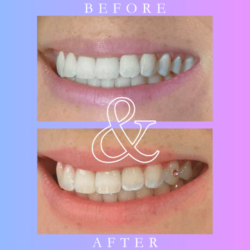 Ocean Dental Surgery Port Macquarie