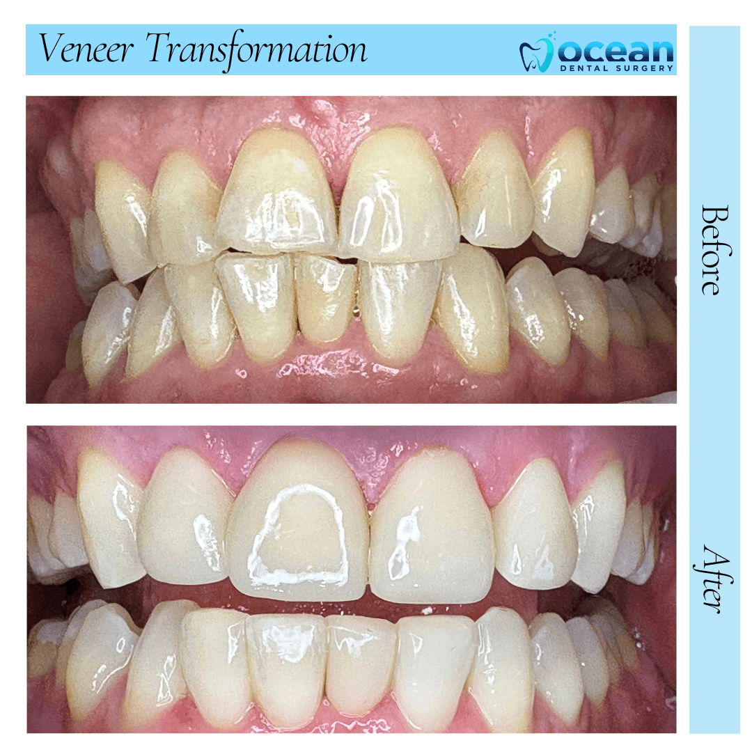 Ocean Dental Surgery Port Macquarie