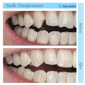 Ocean Dental Surgery Port Macquarie