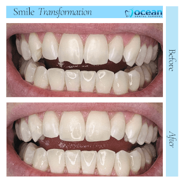 Ocean Dental Surgery Port Macquarie