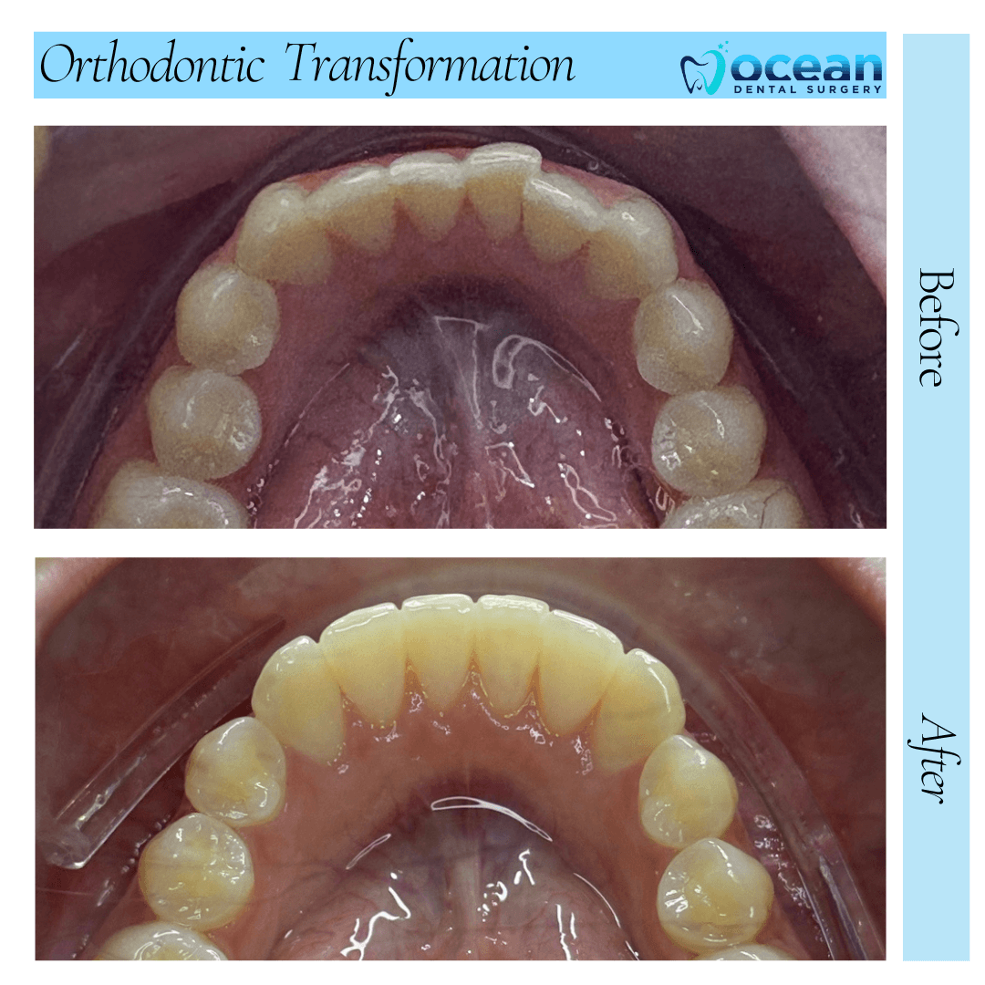 Ocean Dental Surgery Port Macquarie